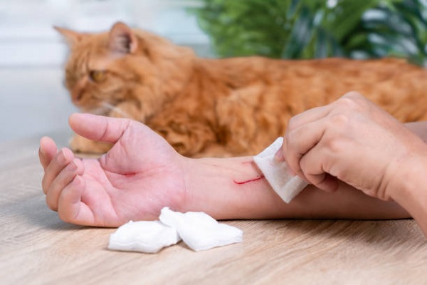 Immediate First Aid for Cat Scratches